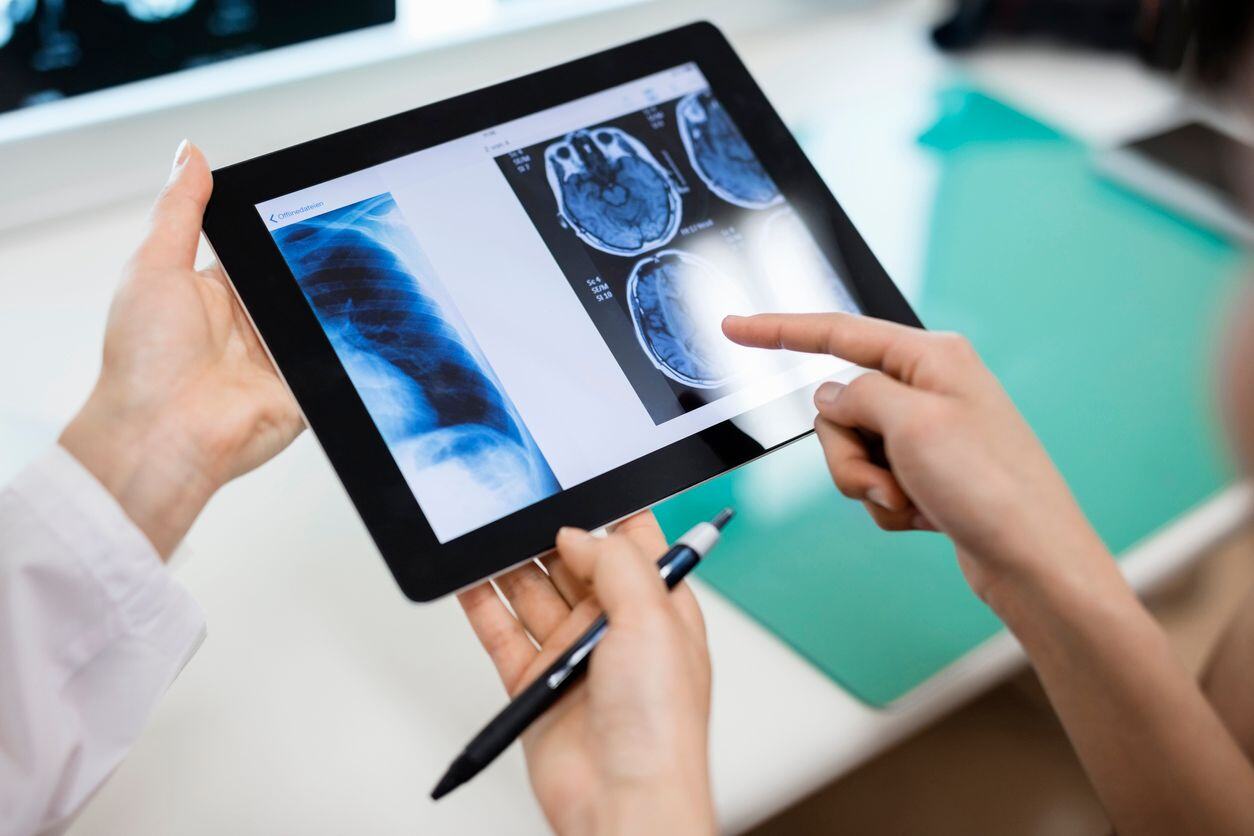 Understanding PACS and Its Integration with Radiology Information Systems
